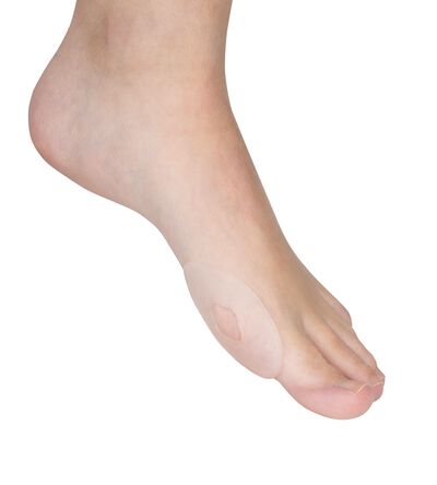  Sj&auml;lvh&auml;ftande gelringar, &rdquo;stora&rdquo;, 4 stycken 